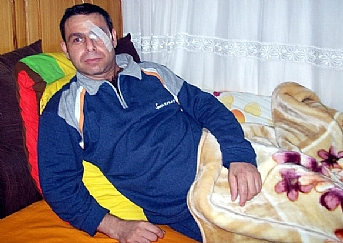 Balık tutma merakı gözüne mal oldu